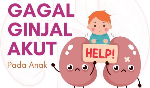 Dikabarkan 99 Anak Meninggal Akibat Gagal Ginjal, Ini Imbauan Polisi Gagal Ginjal Akut Ilustrasi