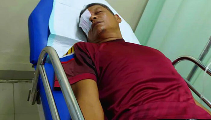 Tegur Siswa Merokok, Guru Dianiaya Hingga Alami Pendarahan dan Harus Dioperasi