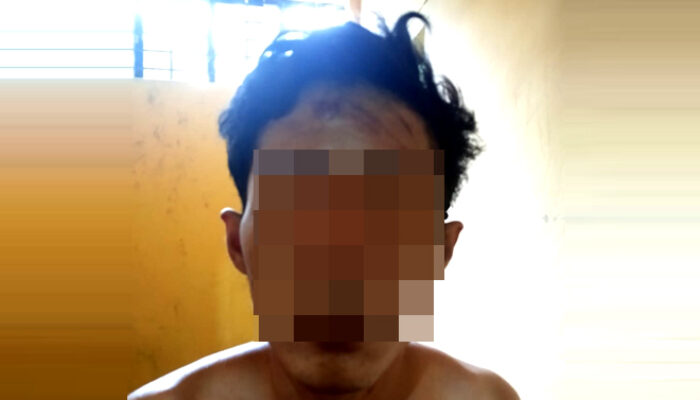 Usai Aniaya Korban, Terduga Pencuri Ini Masuk ke Dalam Sumur